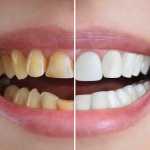 Cosmetic Dentistry