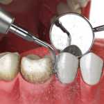 Periodontal Care
