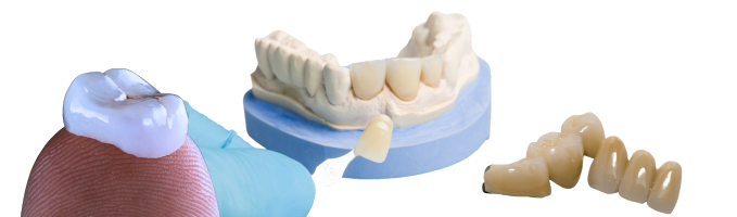 Dental Crowns